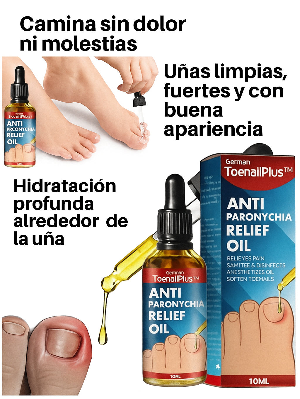 Recupera tus Uñas – Toenailplus®