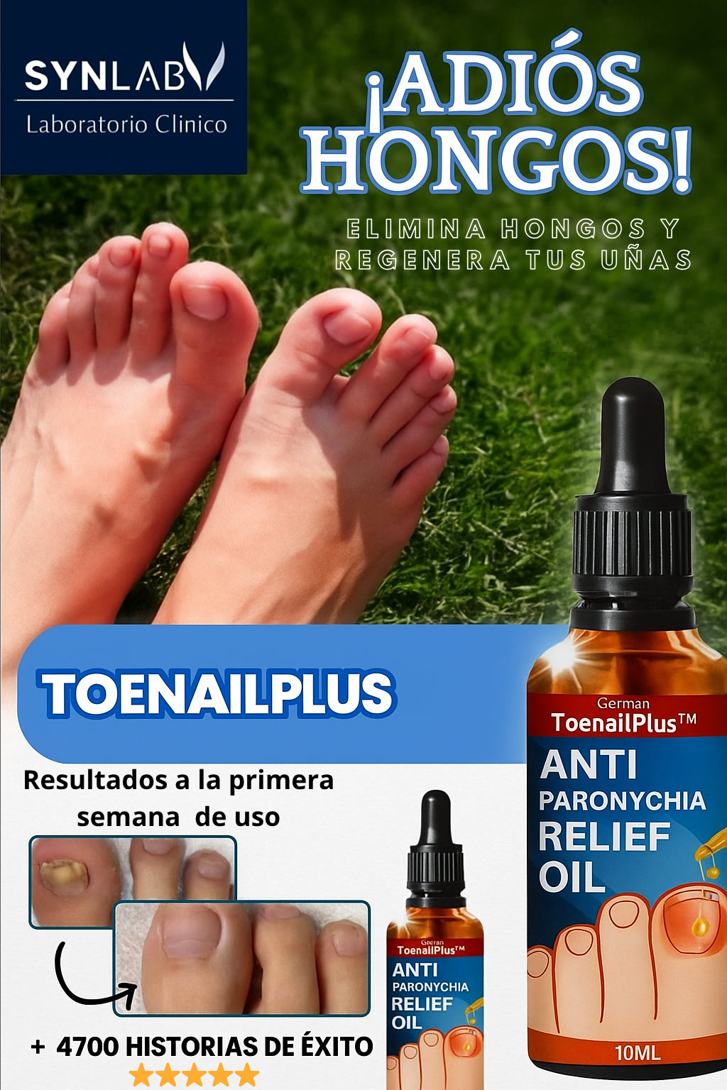Recupera tus Uñas – Toenailplus®