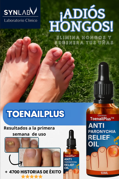 Recupera tus Uñas – Toenailplus®
